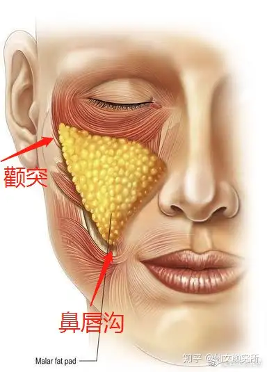 苹果肌不一定会带来少女感反而可能起到反作用