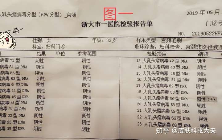 杭州市潘女士hpv56型高危转阴病例分享