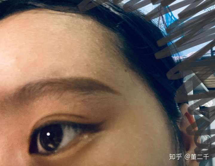 女生左太阳穴有痣代表什么?