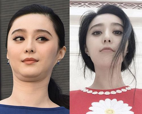 瘦了20斤可是脸上的肉依然没少还是有双下巴怎么回事