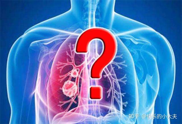 什么样的肺结节是肺癌 6类人要小心 发现结节这样做才安心 知乎 什么样的肺结节是肺癌 6类人要小心 发现结节这样做才安心 知乎