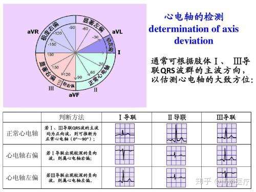 博声医疗 心电轴 心电轴右偏 知乎