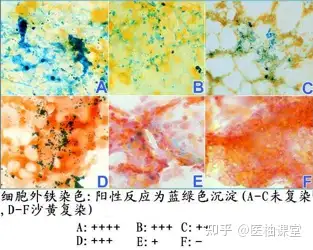 外周血涂片染色图片