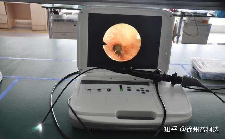 耳鼻喉内窥镜怎样检查咽喉