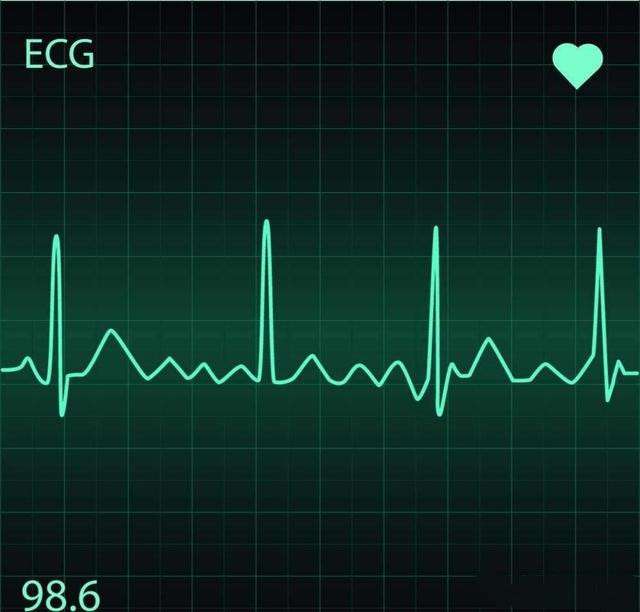8人赞同了该文章 心率和心律虽然读音一样,但其意思不同!