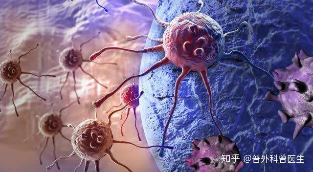 癌细胞通过4种途径转移 转移后出现4个症状 有4种方法控制转 知乎