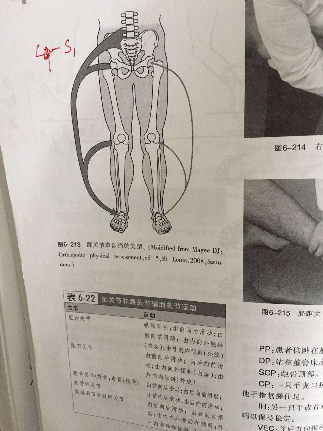 膝痛 元凶竟然是踝扭伤 知乎