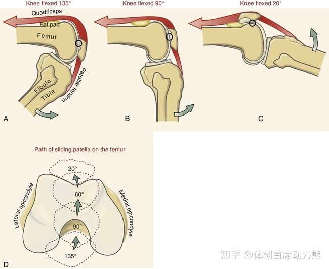膝屈曲过程中,髌骨正确的运动轨迹