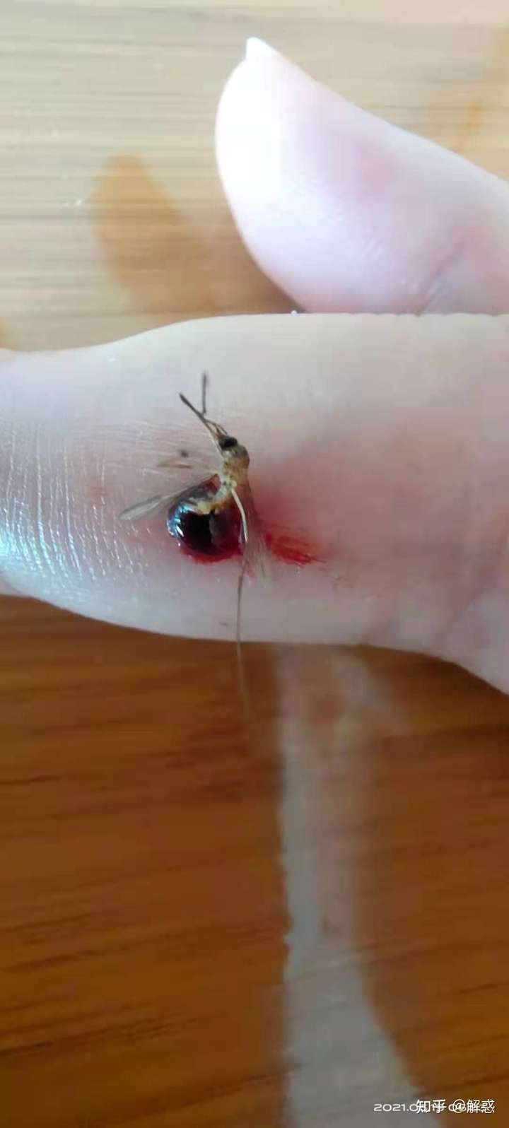 对付蚊子方法多的事,就看你看哪个顺眼了!