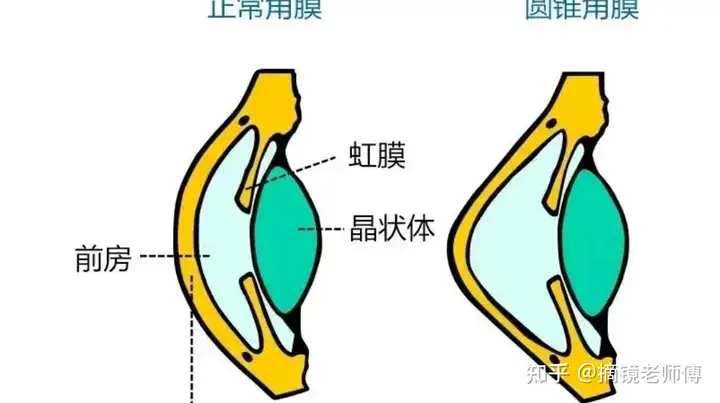 斜震滓媚榨幸襟房衙矩锋？(图2)