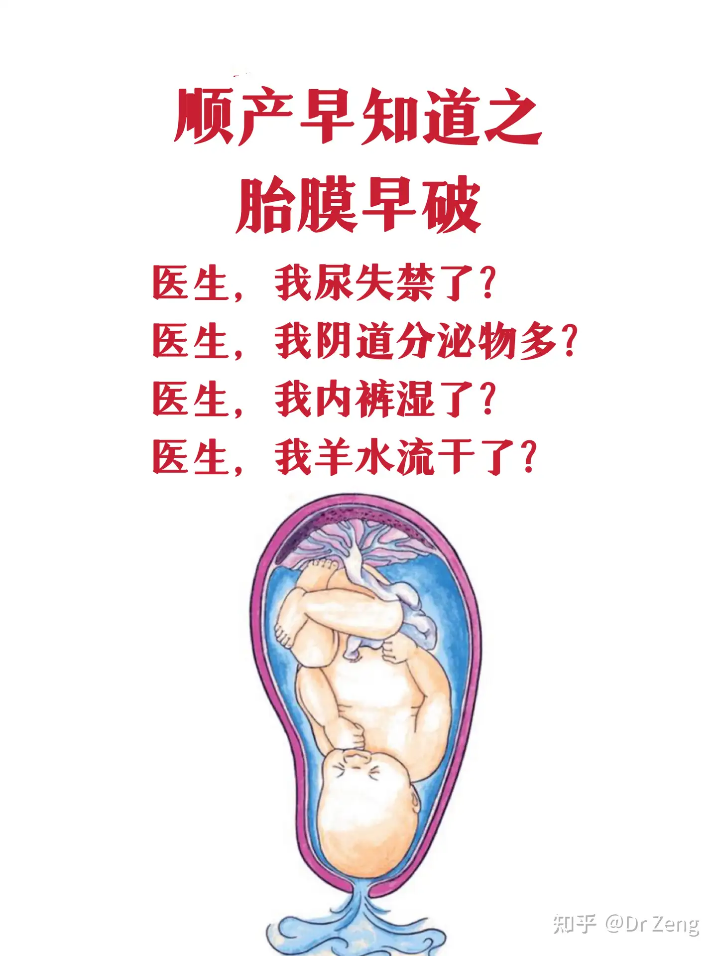 破水了 为什么会提前破水 怎么处理 宝宝会缺氧吗 知乎