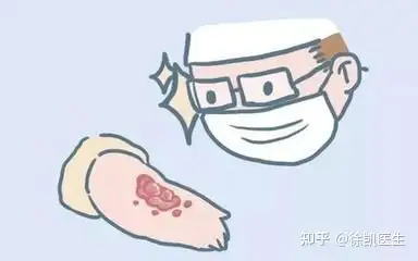 瘢痕疙瘩手术要多少钱