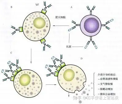 67 在激發階段,相同的變應原與已經和嗜酸性粒細胞/肥大細胞