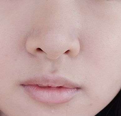拥有宽鼻翼大鼻头是怎样一种体验?