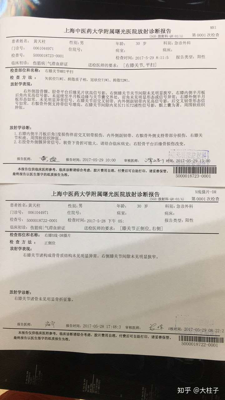 膝蓋半月板前叉韌帶韌帶受傷怎麼康復訓練?