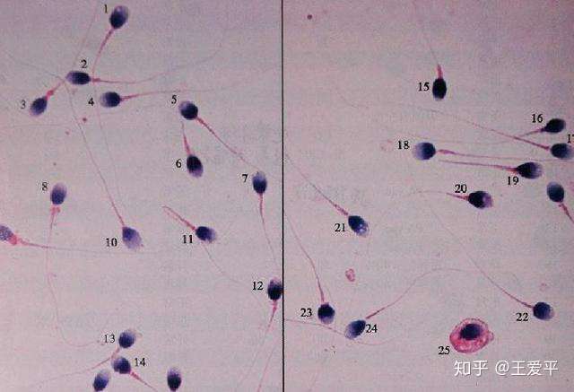 染色体 精子质量三大检查 男性孕前必查利器 知乎