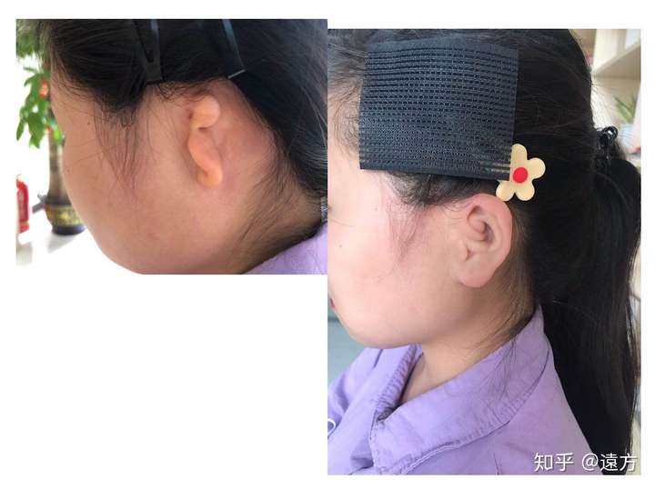 5d义耳什么地方可以做