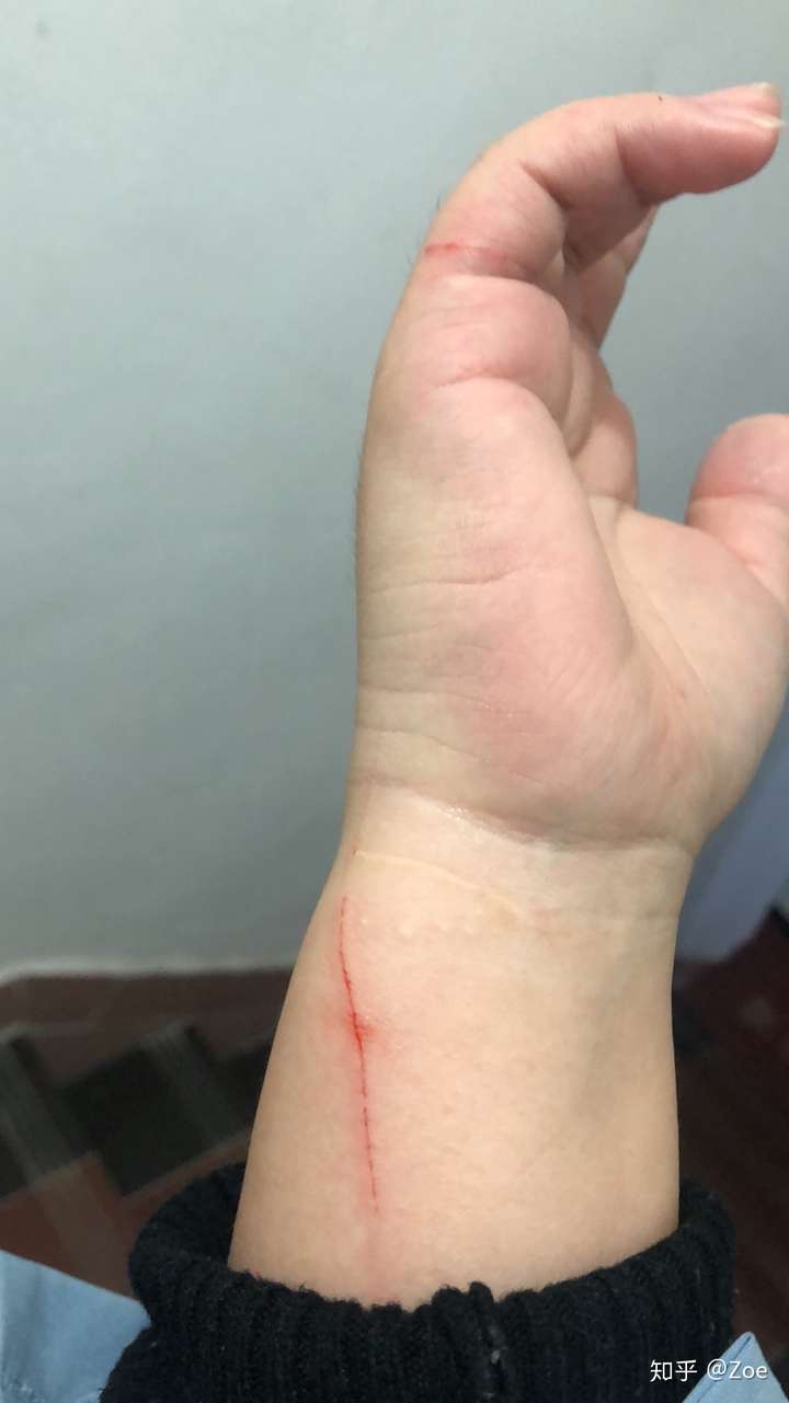 猫抓伤伤痕特点有图图片