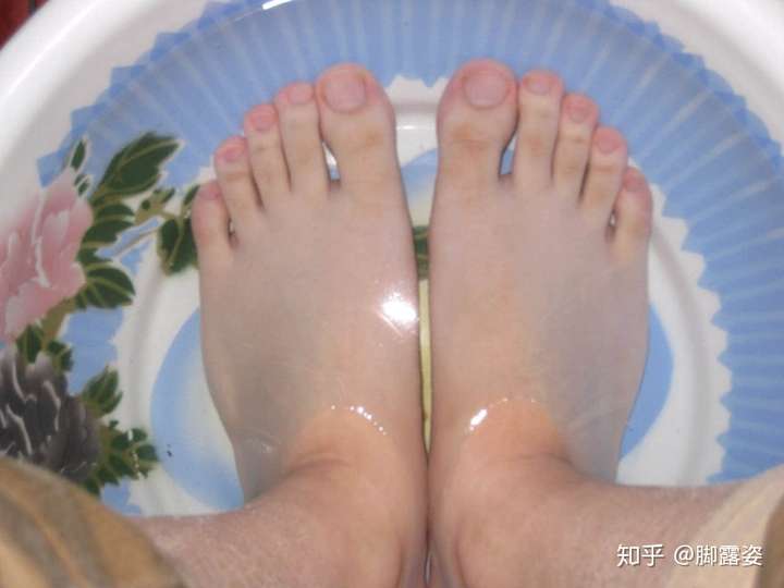 脚露姿 脚气怎么治才能除根 送你治脚气三步曲 知乎