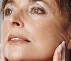 导致皮肤松弛的原因有哪些