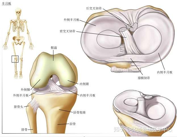 小腿固定,大腿强烈外旋时,易引起外侧半月板前角或内侧半月板后角损伤