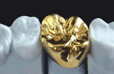 牙冠的常见种类与区别