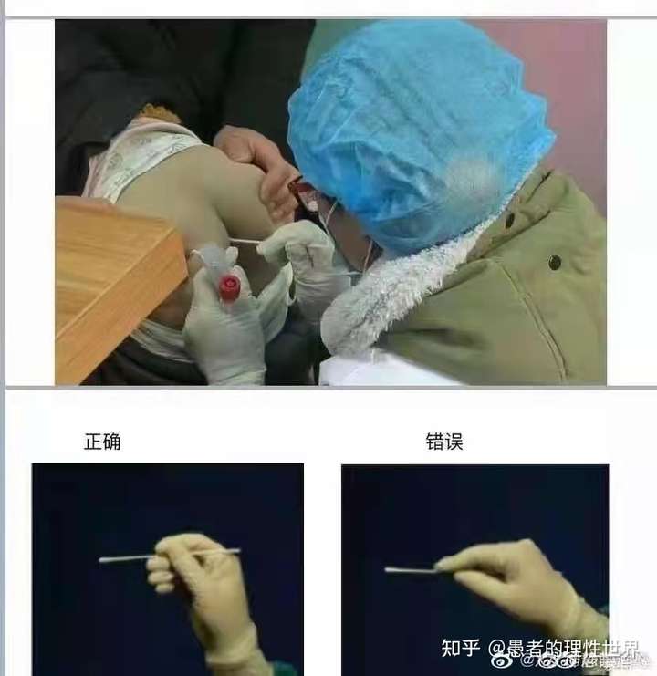 新冠病毒肛试子检测这个检测具体是怎么做的