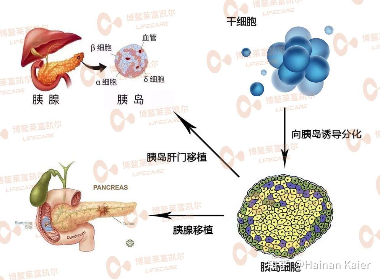 不予注射新冠疫苗 糖尿病患者该如何保护自己 知乎