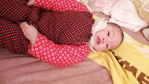 1岁了还是这样:夹腿综合征?