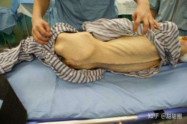 身高169体重41kg胖吗?