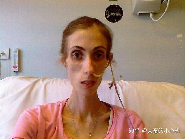 不,这是大腿 好吧,脸也很骨干 60斤真人图有了,这是你想要的吧,好的