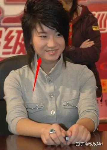 超女冠军尚雯婕整容是因为谁