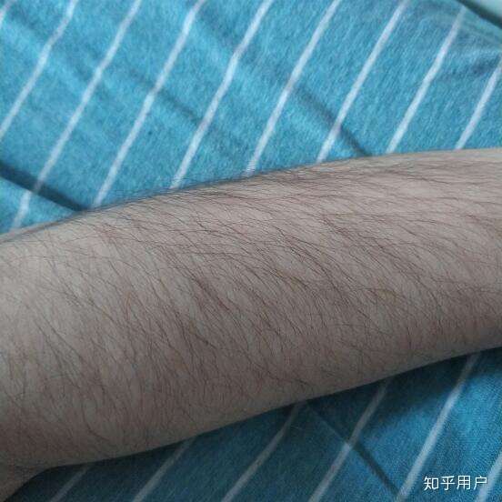 有什么好用的脱毛方法?