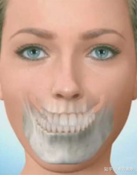 下巴歪了?