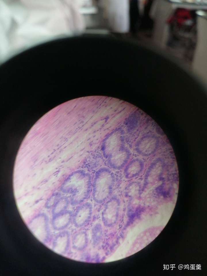 请问平滑肌红蓝铅笔手绘图怎么画