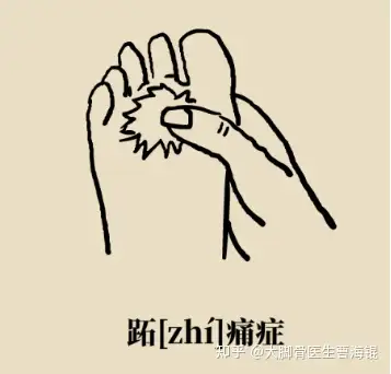 跖痛症的是由哪些病因引起的?