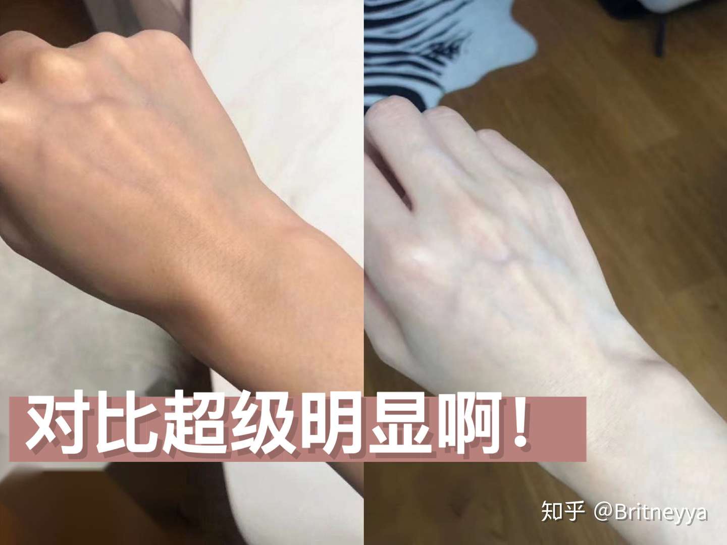 我是如何美白的 知乎