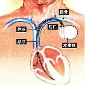 v2-ef5227fe4842d4fe3e7bc64022eef6b7_qhd.jpg