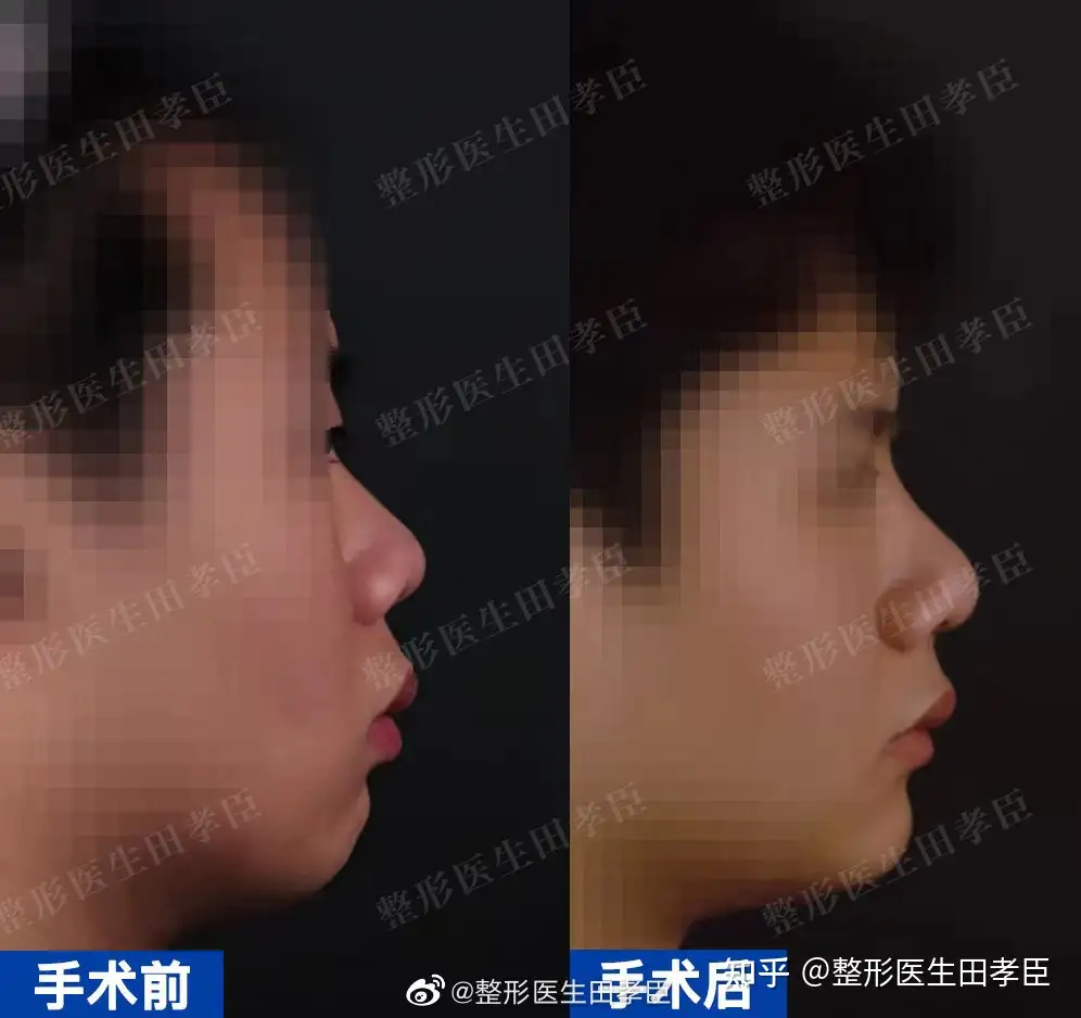 关于男人整容的一些想法- 知乎