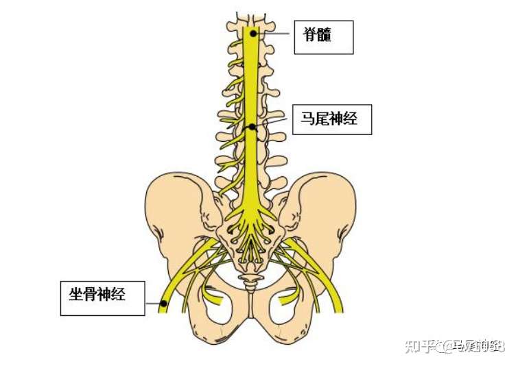 马尾神经损伤早期常见症状有哪些 知道这些避免马尾神经损伤 知乎