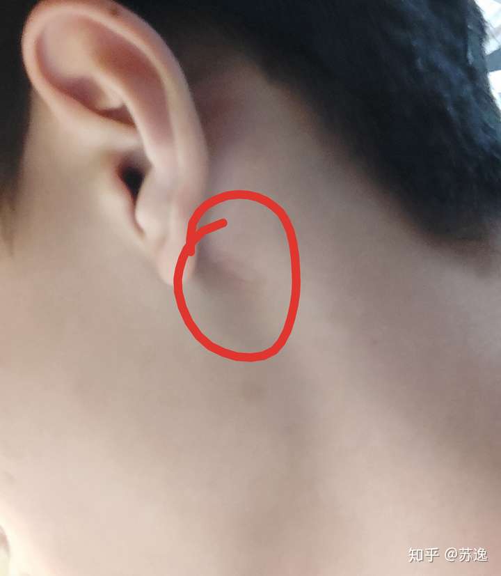 耳朵后面一阵一阵疼痛十六分钟痛了35次是什么原因