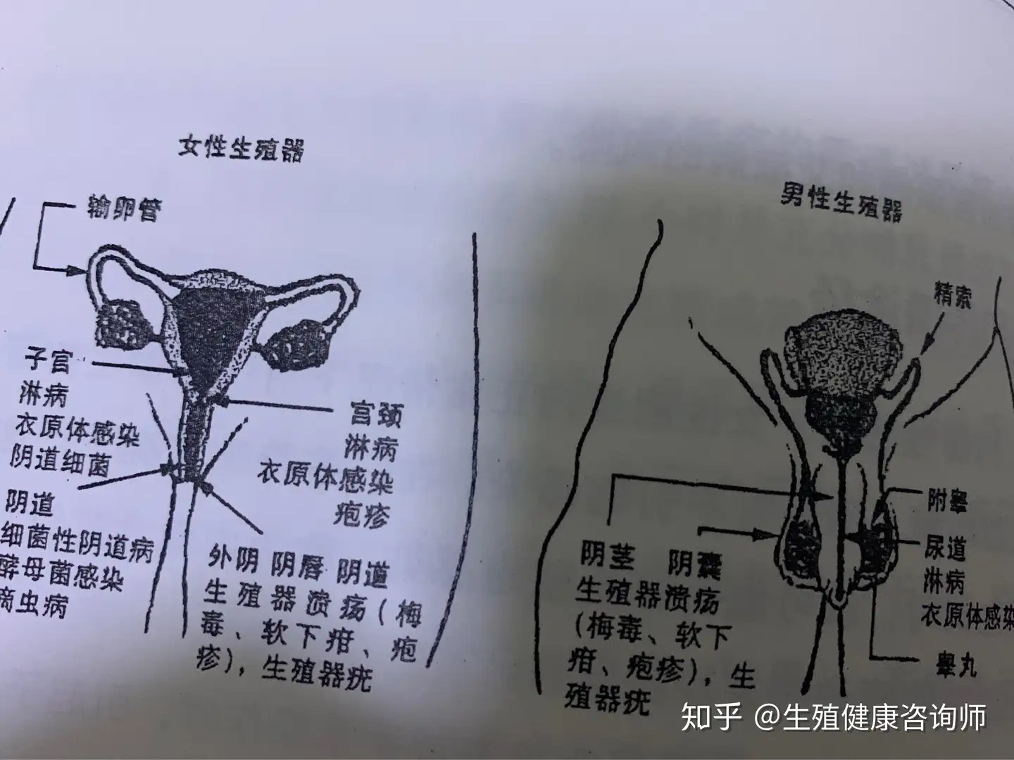 女性 生 器 写真