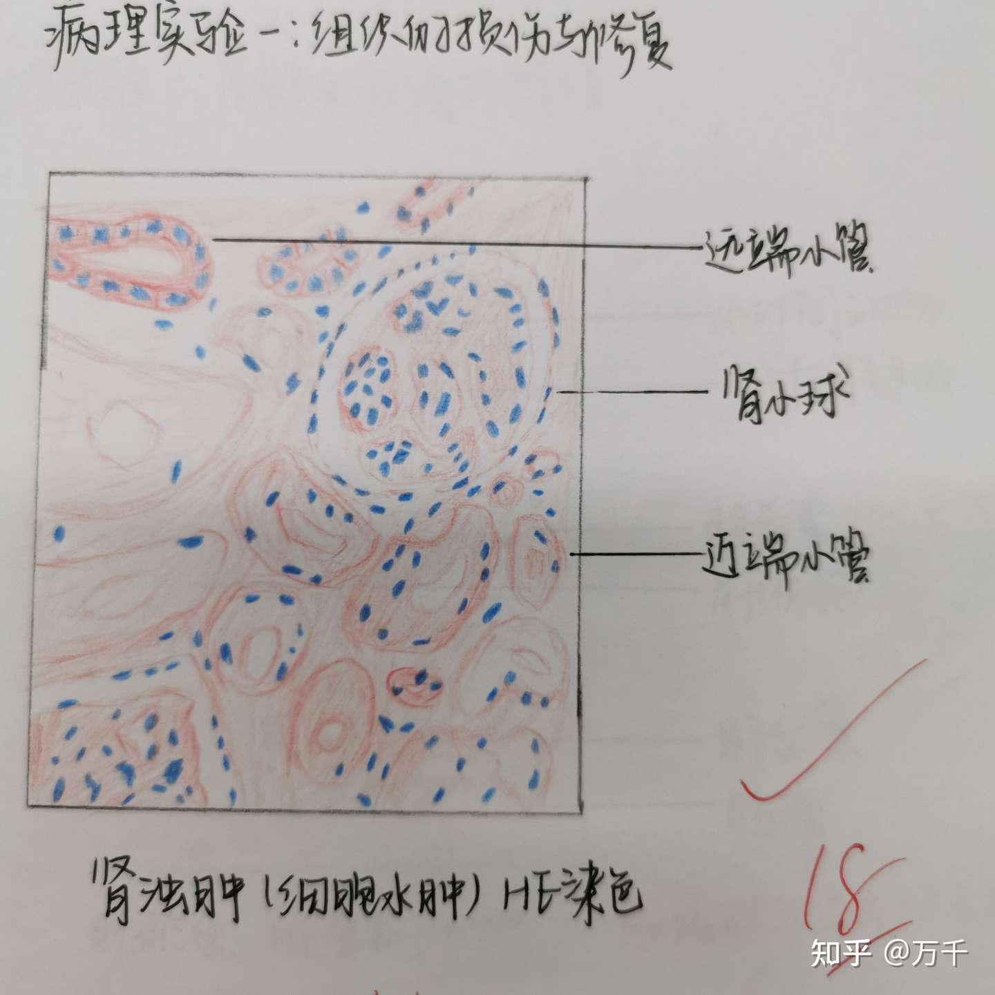 病理学红蓝铅笔绘图- 知乎