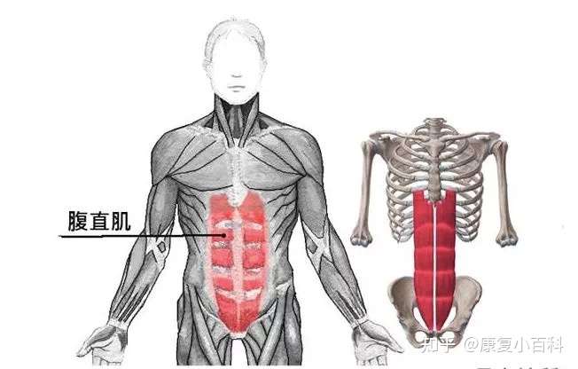 专业知识 腰背酸痛 小心 腹直肌肌筋膜疼痛 知乎