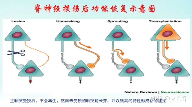 什么是脊髓损伤 脊髓损伤有哪些危害 脊髓损伤该怎么治疗 知乎