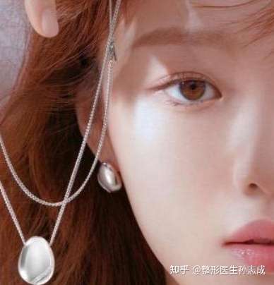 六毫米韩式开扇双眼皮是什么样?