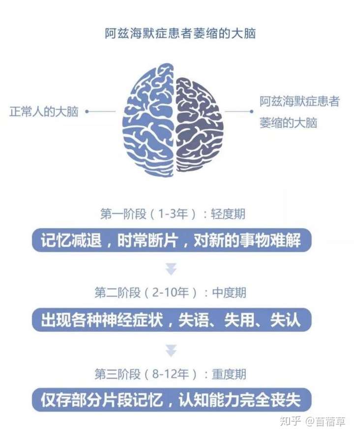 阿尔兹海默症 - 知乎