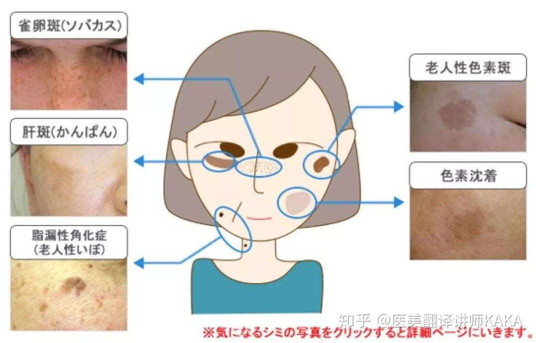 白到发光是怎样的一种体验 知乎