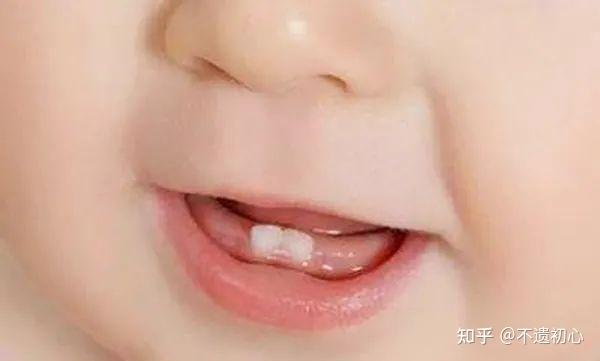 一岁多宝宝一般出几颗牙?