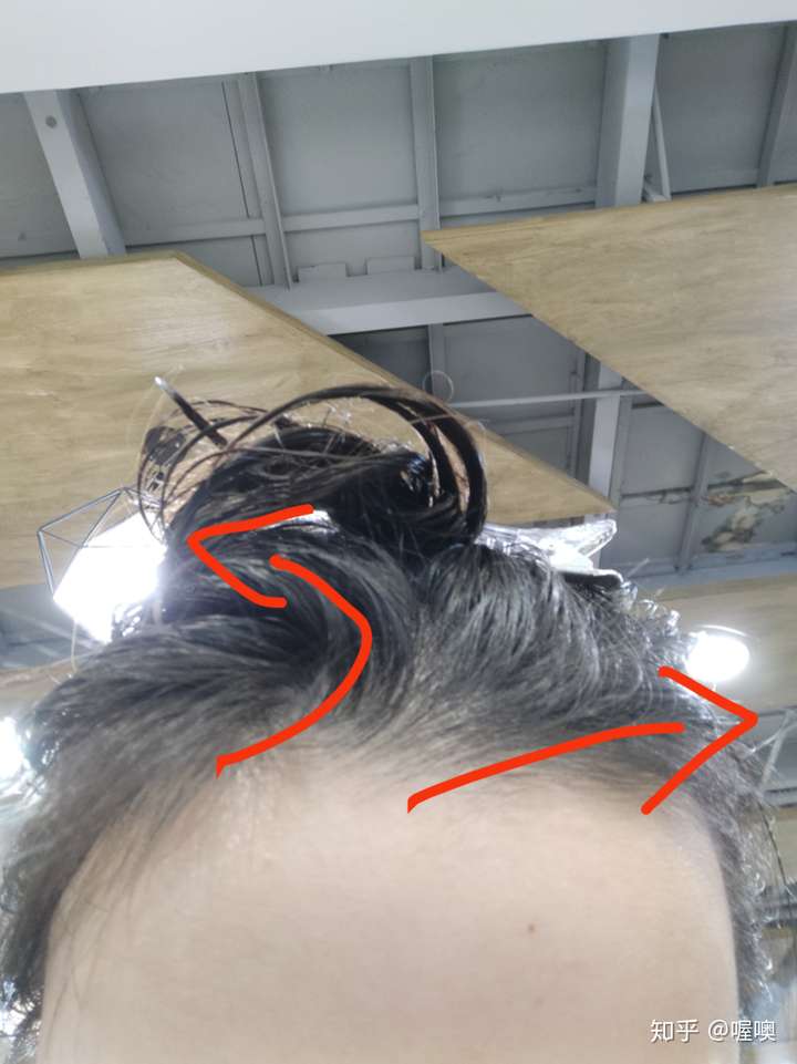 女生发际线处有个旋,很难做发型,有同胞么?怎么破!